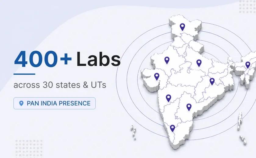 Agilus Diagnostics (Formerly SRL) has 400+ Labs Across India 
