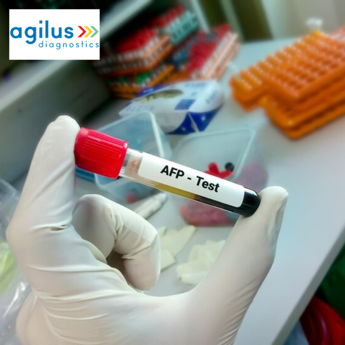 Alpha-Fetoprotein Test- The Technique And The Results& - Agilus Diagnostics
